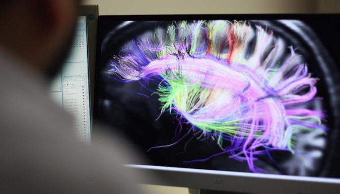 Beynin elektrik bağlantılarının haritası çıkarıldı