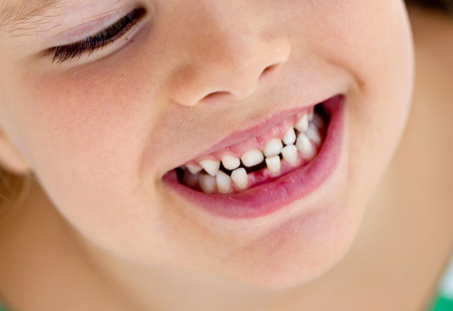 Çocuklarda okul öncesi diş sağlığı